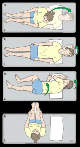 Diagram showing Epley manoeuvre for BPPV